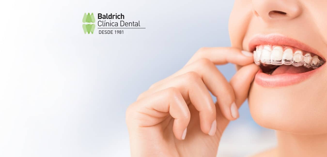 ventajas ortodoncia invisalign