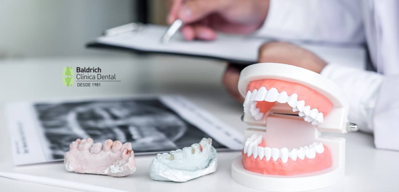 dental prosthesis