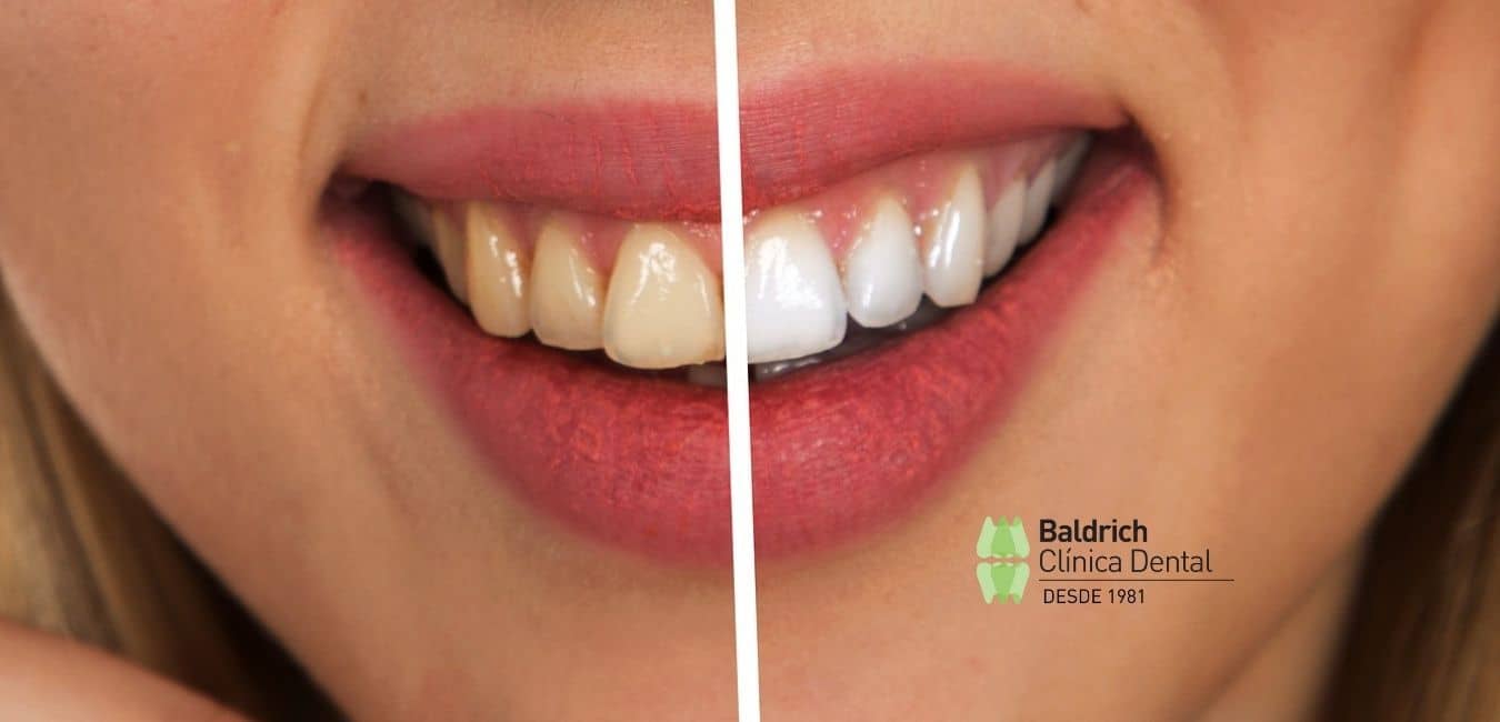 estética oral y estética dental