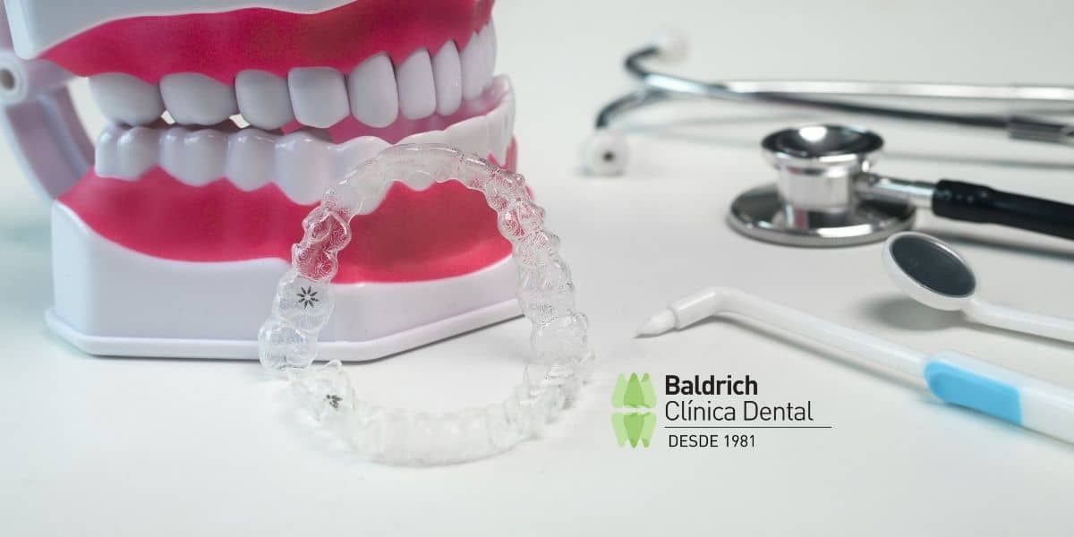 dental aligner