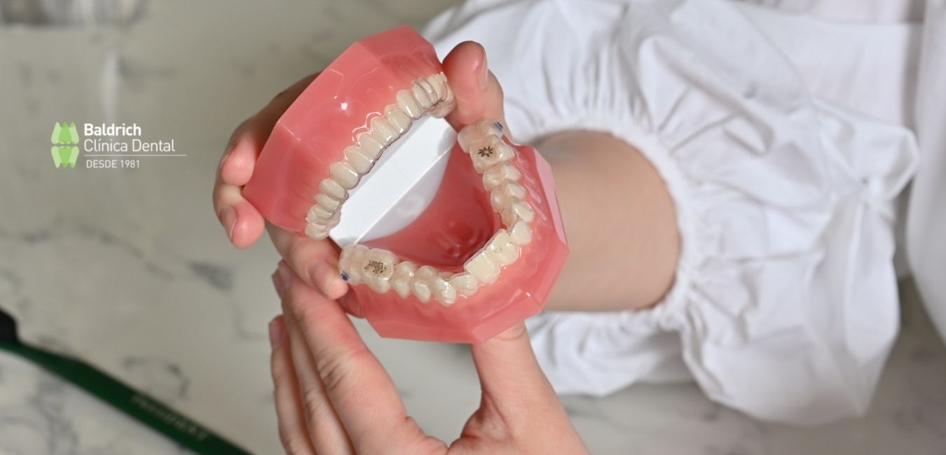 prótesis dental fija