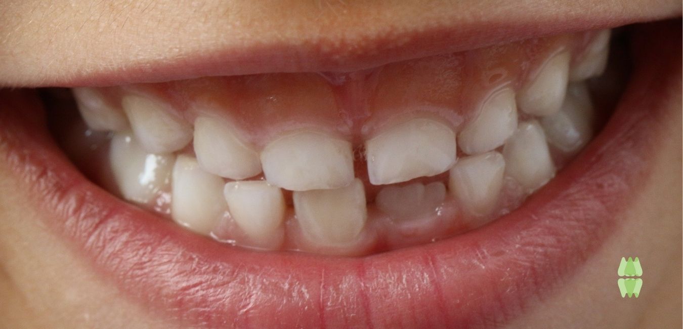 dentista infantil