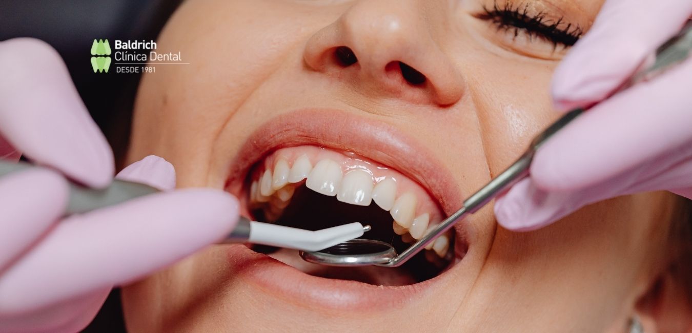 limpieza dental