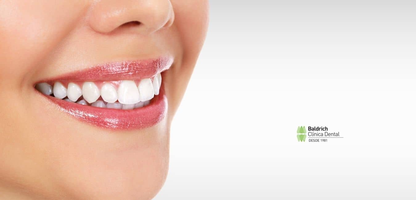 blanqueamiento dental