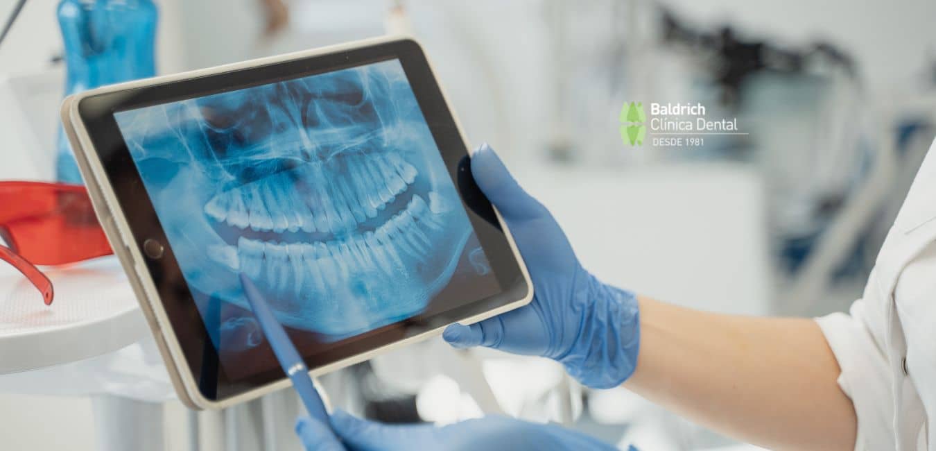 radiografía dental