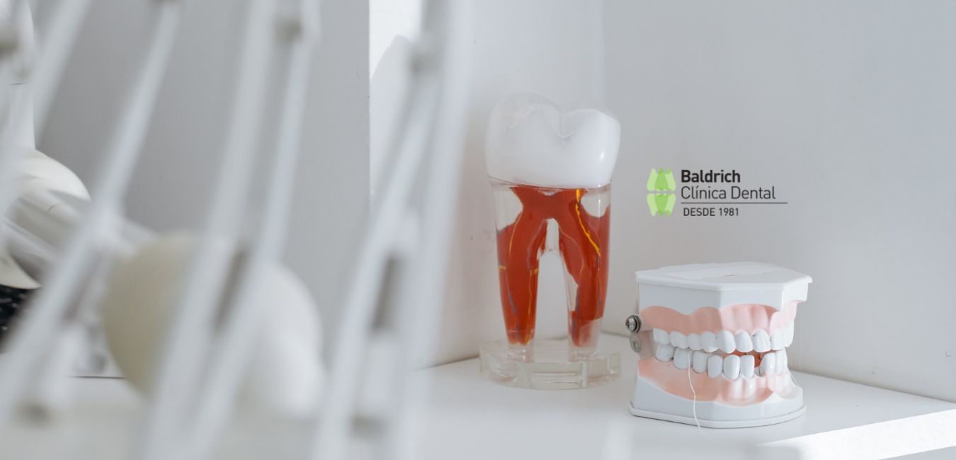 tratamientos clínica dental Viladecans