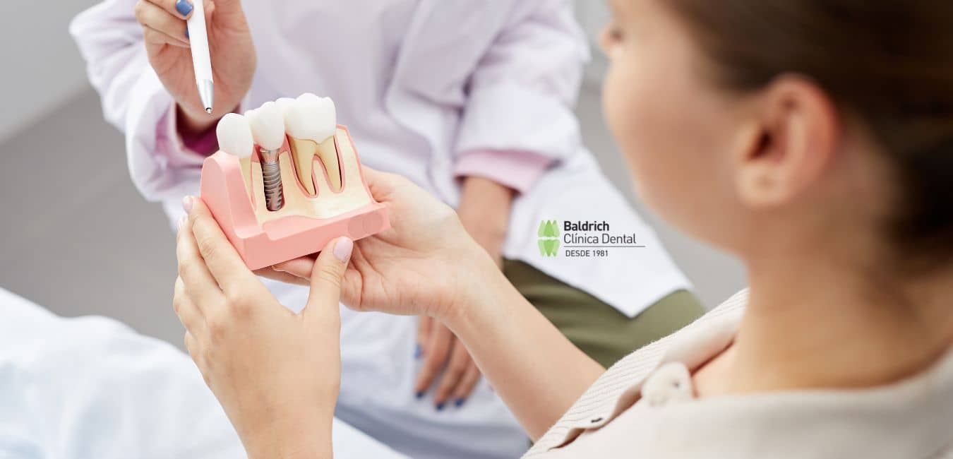 tipos de implante dental