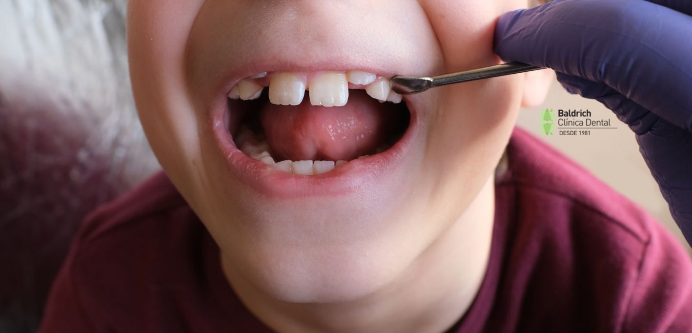 Odontología infantil en Viladecans