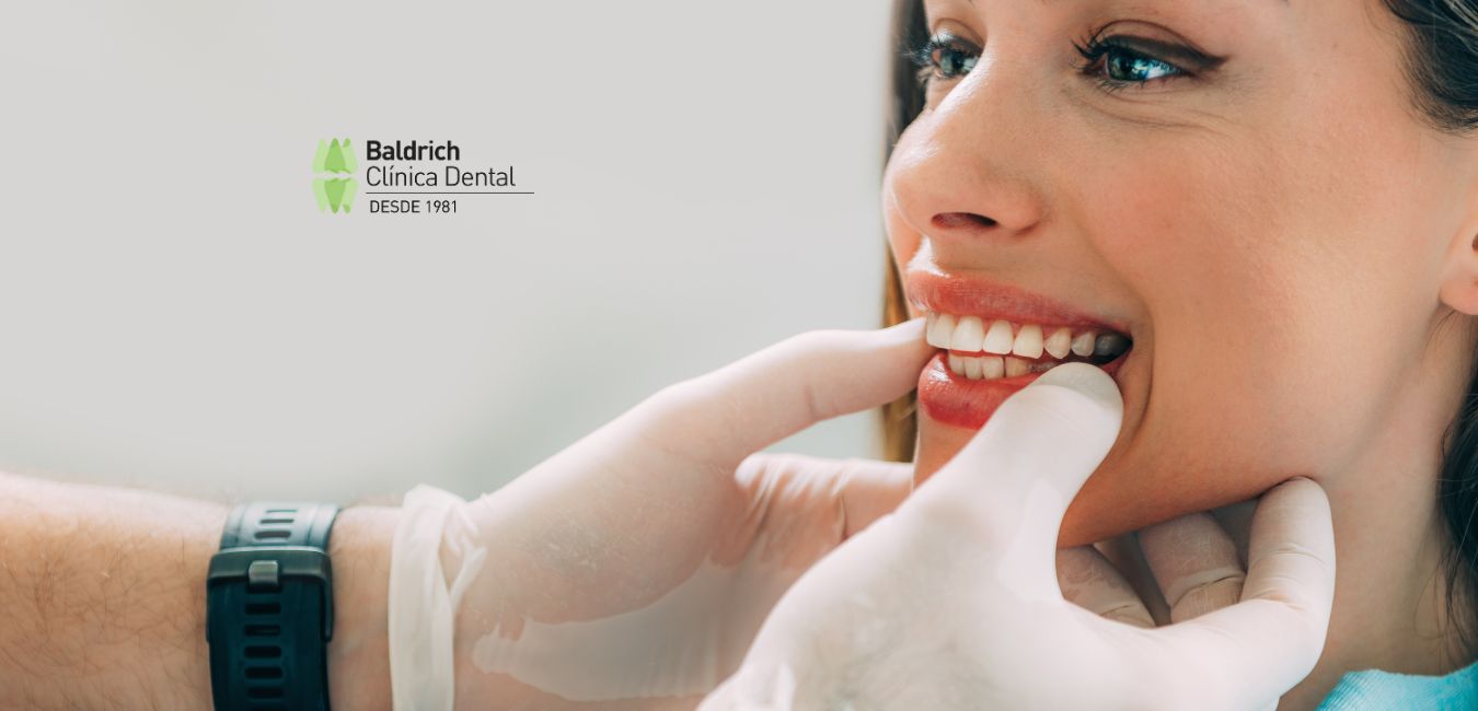 estética dental