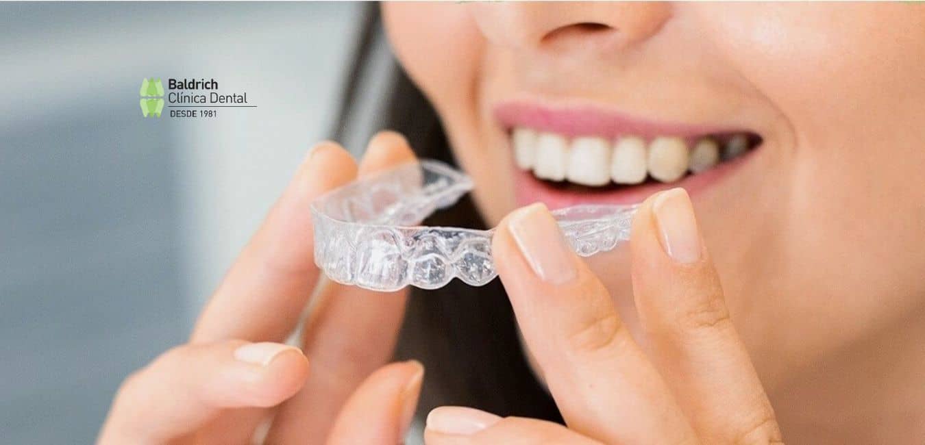 Invisalign ortodoncia invisible