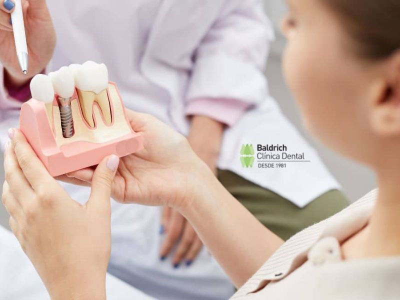 tipos de implante dental