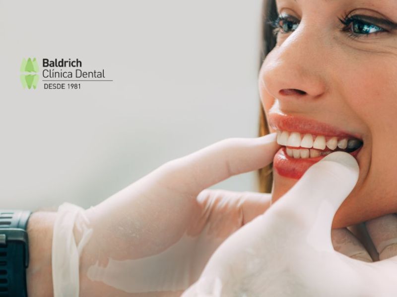 estética dental