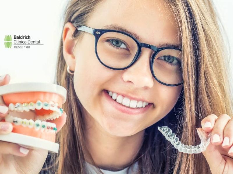brackets invisibles Viladecans