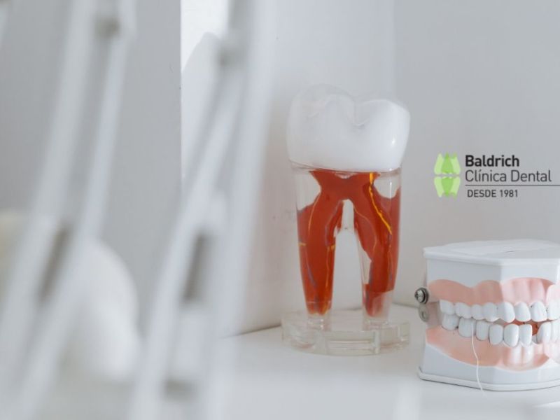 tratamientos clínica dental Viladecans