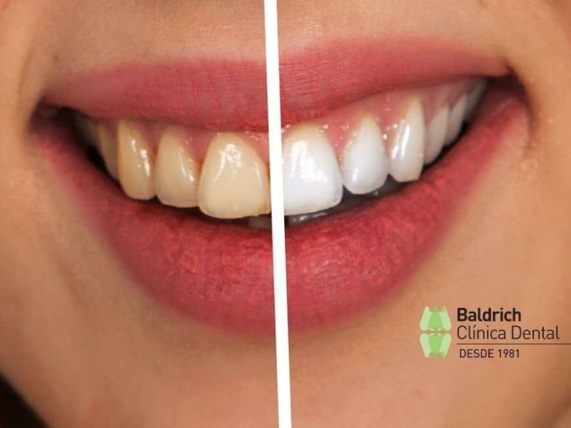 oral esthetics