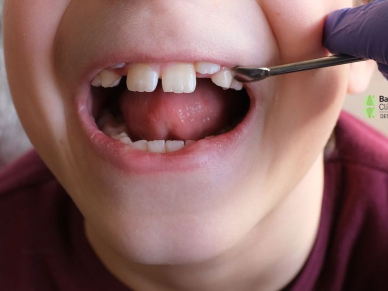 Odontología infantil en Viladecans