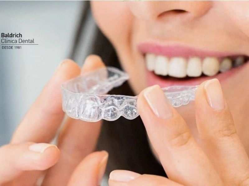 Invisalign ortodoncia invisible