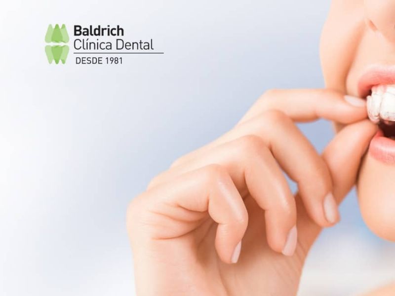 ventajas ortodoncia invisalign
