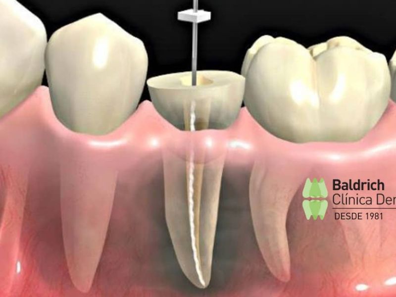 what is a endodontics