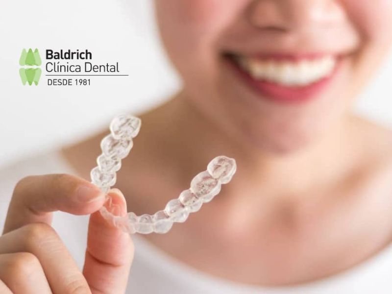 qué es Invisalign
