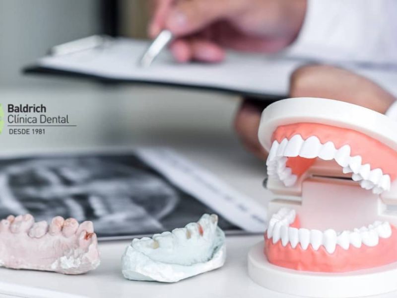 dental prosthesis