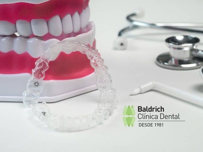 dental aligner