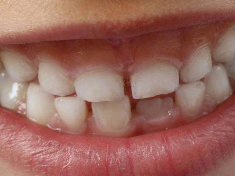 childrens-dentist