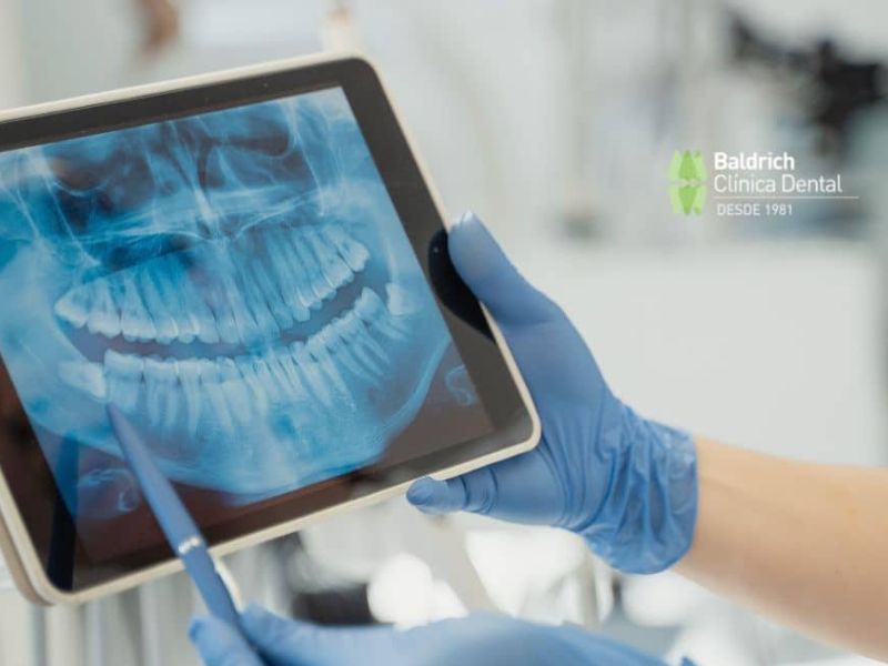radiografía dental
